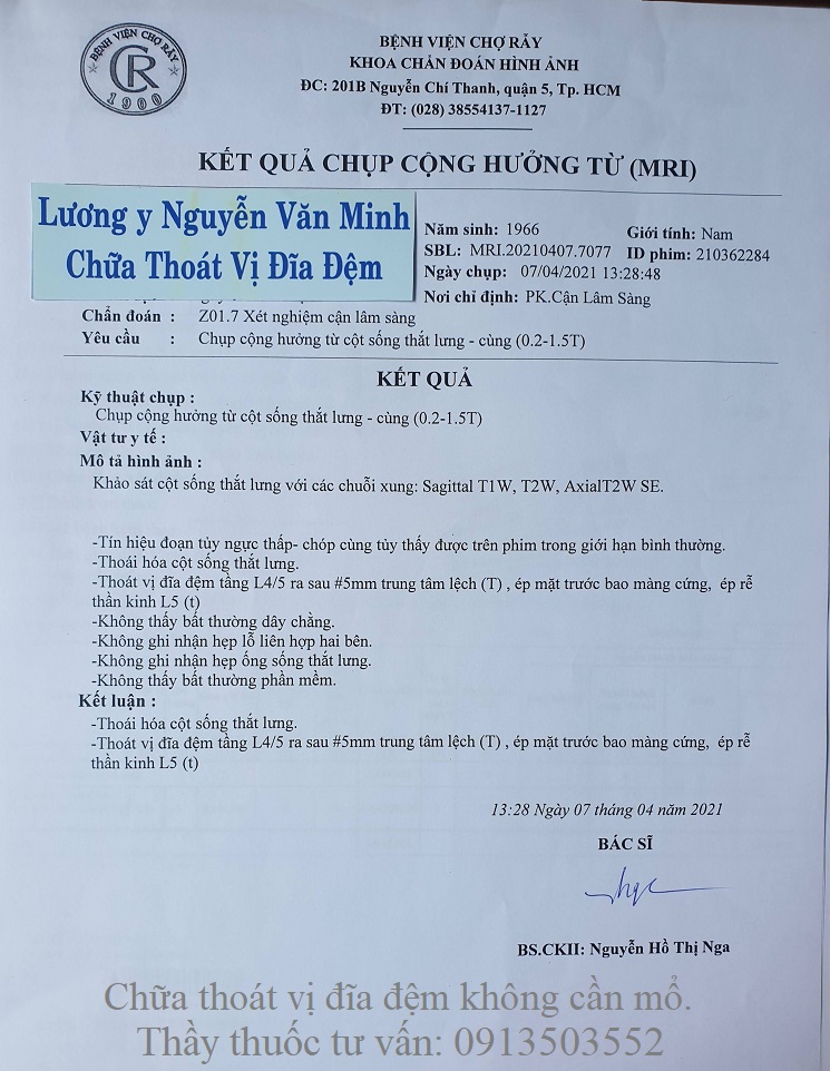 Chữa thoát vị đĩa đệm không cần mổ